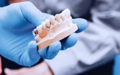 Implantología y cirugía oral